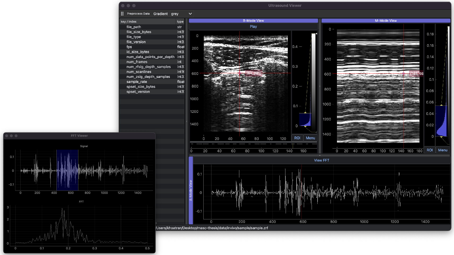 Ultrasound data analysis GUI desktop application